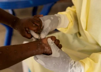 Africa's Mpox Crisis Escalates to Global Emergency